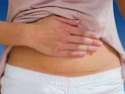 Abdominoplasty absorbable suture