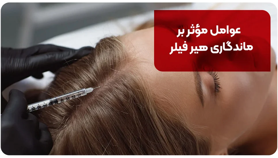 عوامل مؤثر بر ماندگاری هیر فیلر