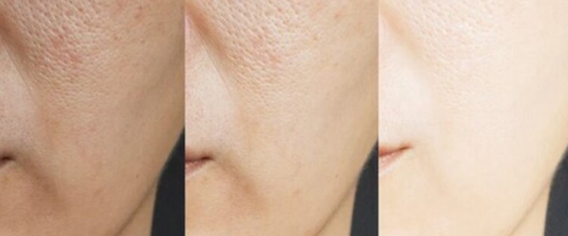 تجربه کاربران و نتایج واقعی استفاده از سیلکر